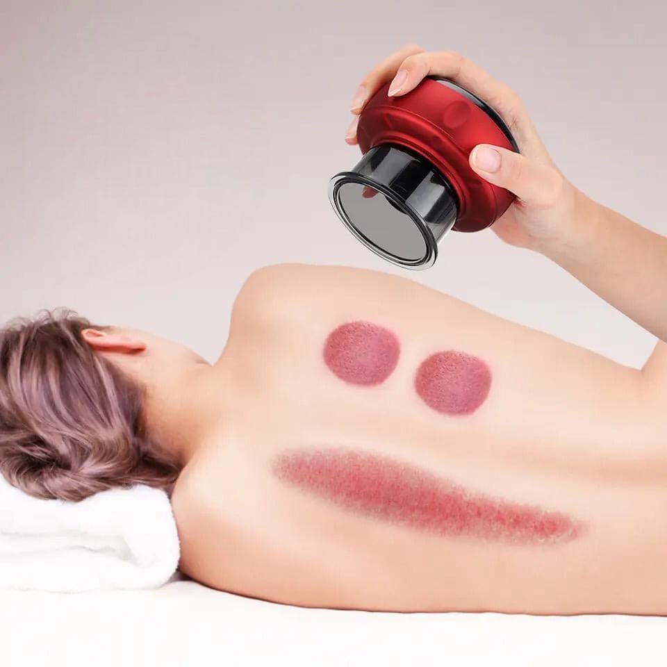 Electric Cupping Massager, Anti Cellulite Wireless Massager, 3 In 1 Electric Handheld Dynamic Suction Massager, Electric Anti Cellulite Suction Cup, Vacuum Cupping Massager, Guasha Scraping Fat Burner Device Electric Cupping Massager, Anti Cellulite Wireless Massager, 3 In 1 Electric Handheld Dynamic Suction Massager, Electric Anti Cellulite Suction Cup, Vacuum Cupping Massager, Guasha Scraping Fat Burner Device